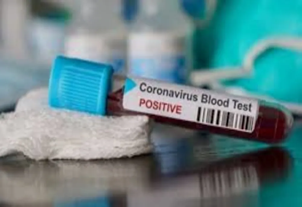 Autoritățile au anunțat cu puțin timp în urmă noi decese în România, ca urmare a infecției cu coronavirus. Bilanțul deceselor în România - 203 
