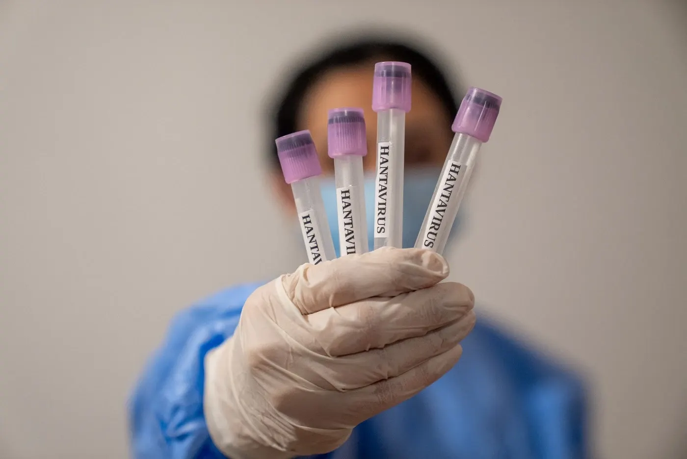 Hantavirus în România