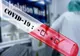 Încă 5 români răpuși de coronavirus. Bilanțul deceselor a ajuns la 156.
