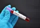 Bilanț coronavirus 21 ianuarie: 2.878 cazuri noi și 69 decese